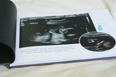 Hacer un álbum con ecografía de bebé